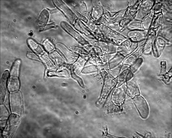 Xerocomus da determinare